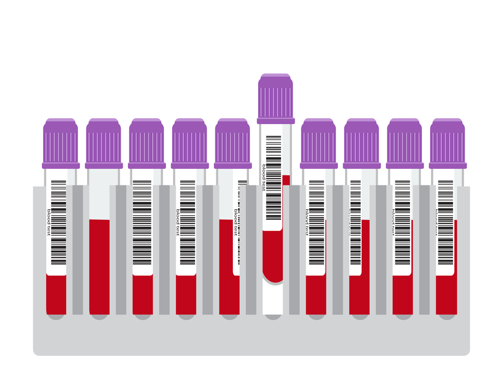Blood testing, blood results, blood device, KP Pharma, Doctor wellness, Easy Bloods, In-clinic blood device, blood lab, blood test, vitamin d,